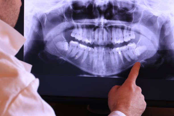Best Root Canal Emergency Dentist  in Manchaca, TX