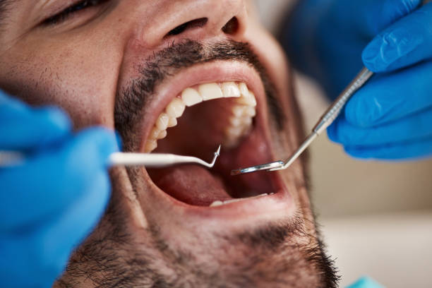 Best Broken Tooth Emergency  in Manchaca, TX